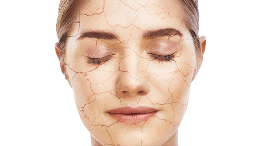Peau déshydratée : causes, symptômes et solutions efficaces